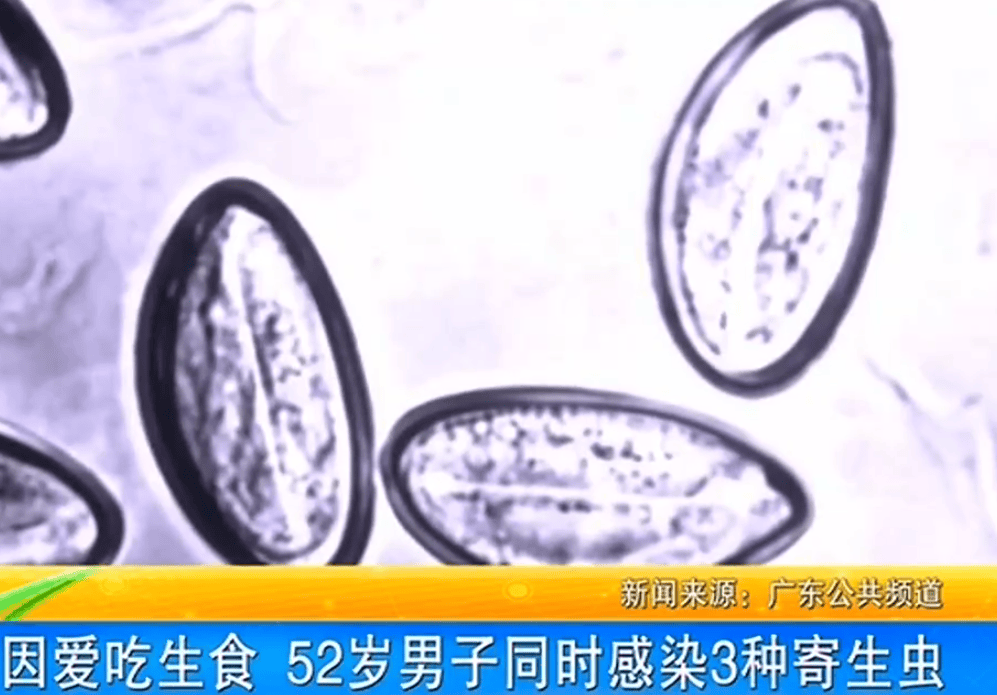 女子体内排出10米长绦虫<strong></p>
<p>虚拟币建群</strong>！原是两年前旅游时吃了这种食物