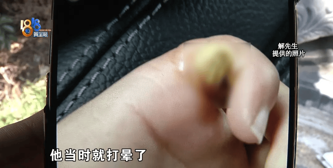 5岁男童瞬间晕厥<strong></p>
<p>虚拟牛莱币</strong>，筋都断了！街上常见，看见立即远离