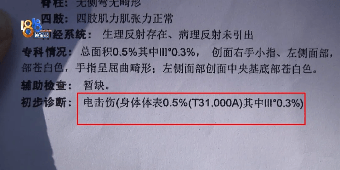 5岁男童瞬间晕厥<strong></p>
<p>虚拟牛莱币</strong>，筋都断了！街上常见，看见立即远离