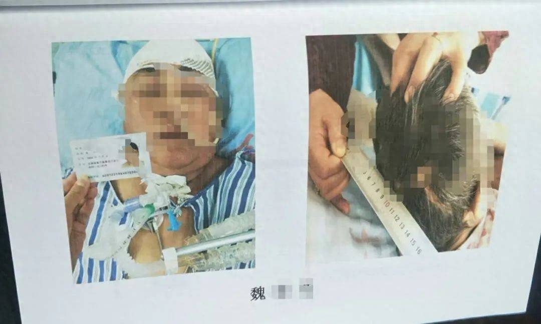 目睹母亲过马路被车撞<strong></p>
<p>美国交易所虚拟币</strong>，27岁女子受惊吓5天后身亡