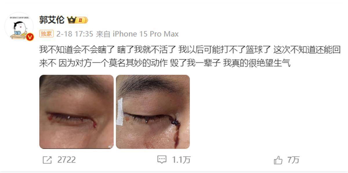 郭艾伦发文报平安：已顺利拆线<strong></p>
<p>虚拟币 狗币</strong>，相信一定会重回球场