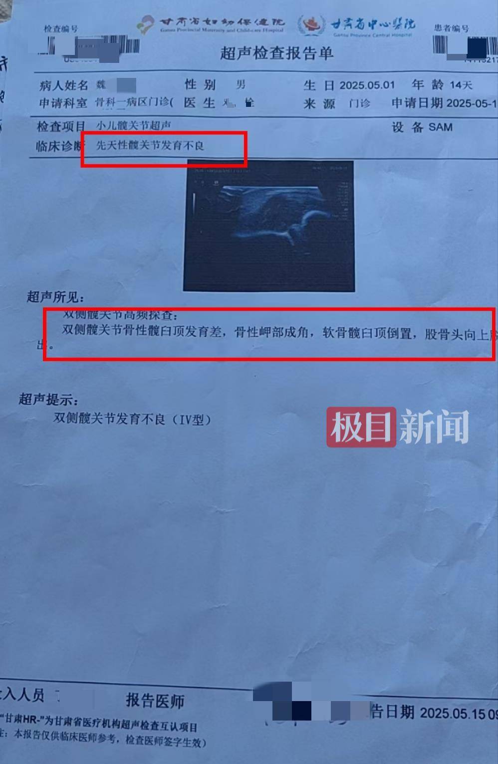 二胎出生查出先天性病症或落下残疾<strong></p>
<p>虚拟货币世界币</strong>，残疾父母称医院产检漏检、未尽告知义务，医院及医调委回应