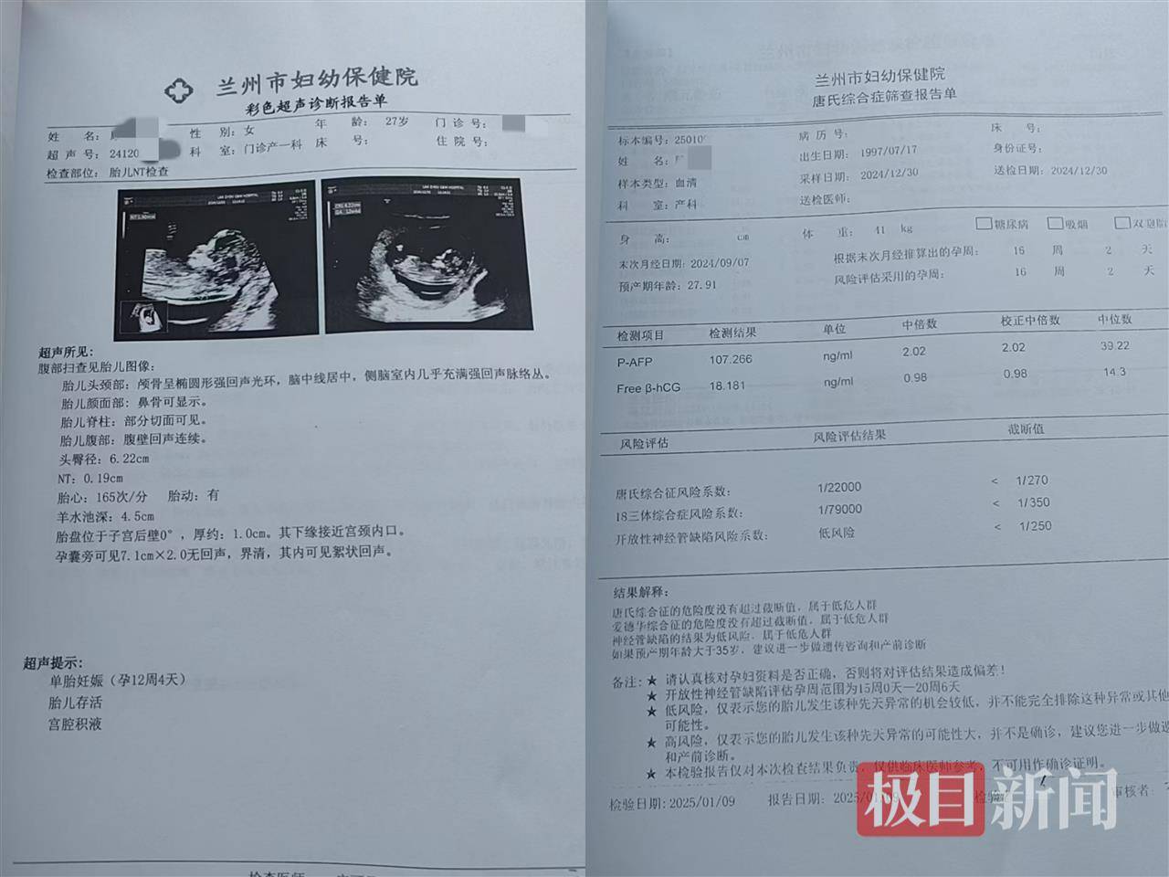 二胎出生查出先天性病症或落下残疾<strong></p>
<p>虚拟货币世界币</strong>，残疾父母称医院产检漏检、未尽告知义务，医院及医调委回应