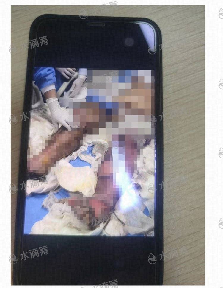 成都一小区电瓶车楼道“飞线充电”酿火灾<strong></p>
<p>虚拟币LOL</strong>，一家四口1死2伤，涉事车主被刑拘