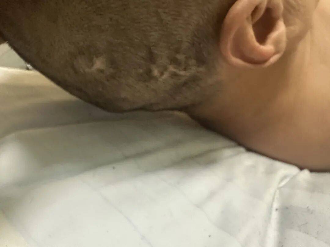 4名游客景区内遭马蜂袭击<strong></p>
<p>宁波银行股票</strong>，旅游度假区：是森林公园不卖门票，蜇伤先就医后提供证据投诉