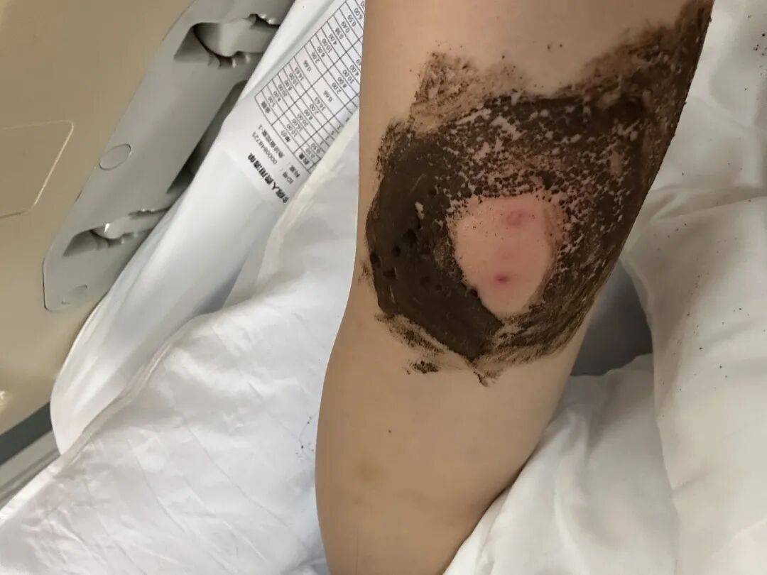 4名游客景区内遭马蜂袭击<strong></p>
<p>宁波银行股票</strong>，旅游度假区：是森林公园不卖门票，蜇伤先就医后提供证据投诉