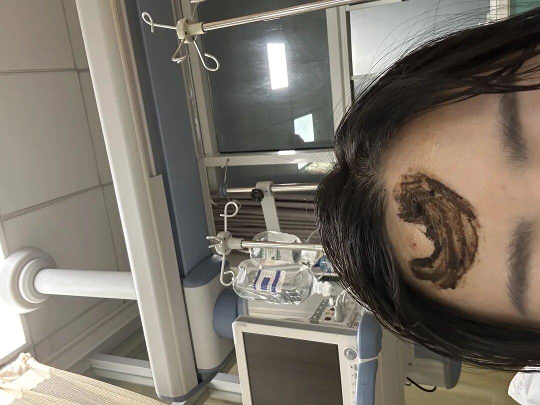 4名游客景区内遭马蜂袭击<strong></p>
<p>宁波银行股票</strong>，旅游度假区：是森林公园不卖门票，蜇伤先就医后提供证据投诉