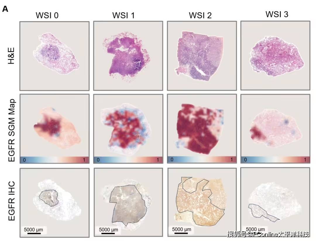 准确率高达 99%<strong></p>
<p>金安国纪股票</strong>！腾讯 AI 可预测肺癌基因突变