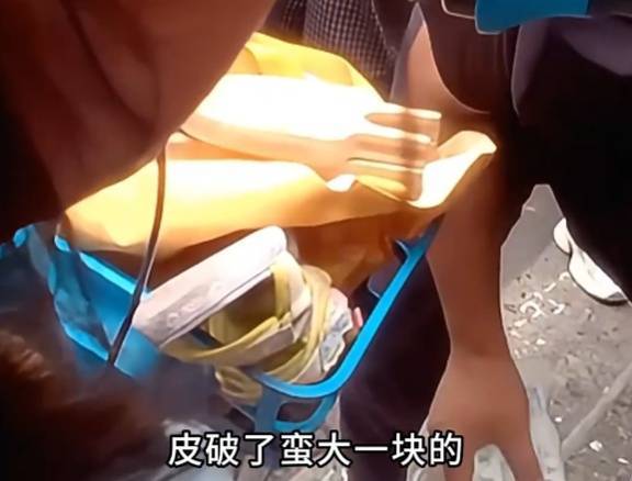 看着都疼<strong></p>
<p>华友钴业股票</strong>！上海街头一男子突然求助：10岁女儿被死死卡住！这个行为太危险→