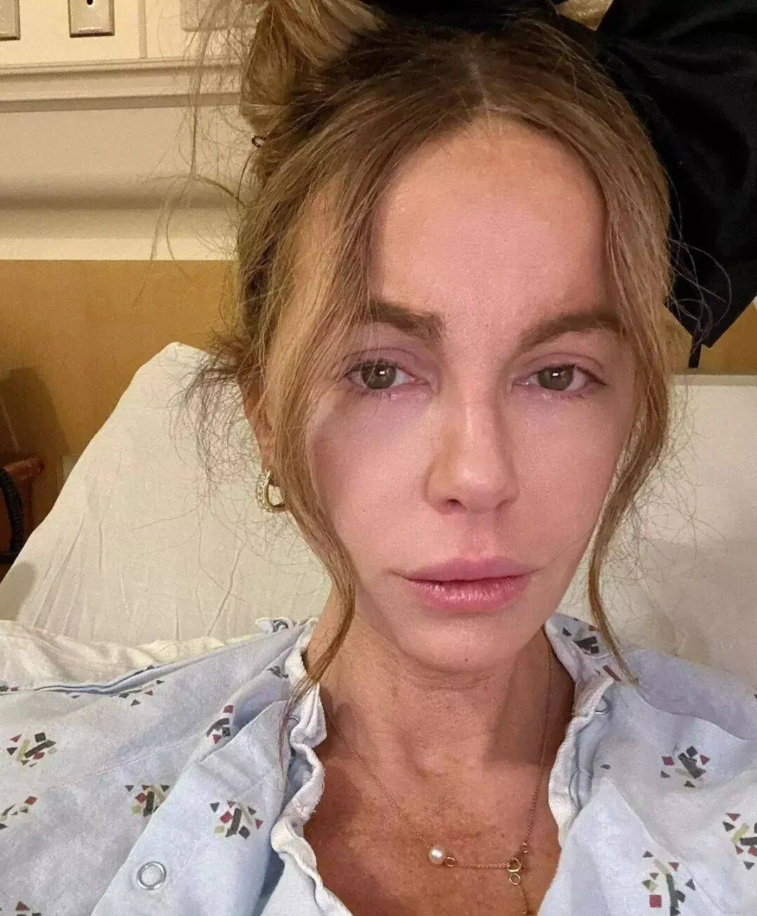 最美吸血鬼如今瘦成骷髅<strong></p>
<p>久其软件股票</strong>？《珍珠港》女主究竟怎么了？