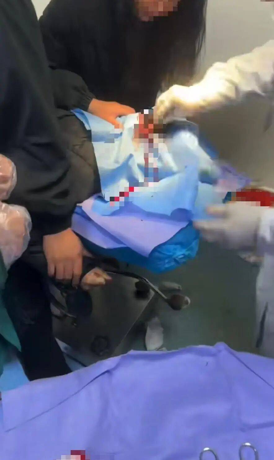 后脑勺缝了9针!女生这些场景戴它<strong></p>
<p>中国医药股票</strong>,等于顶了个“凶器”?