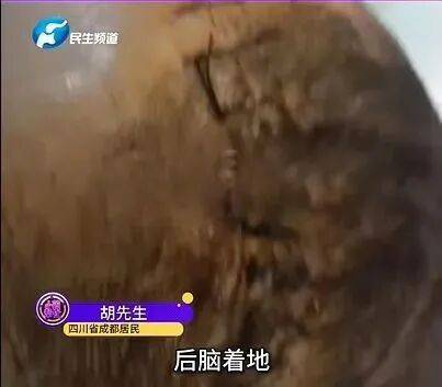 后脑勺缝了9针!女生这些场景戴它<strong></p>
<p>中国医药股票</strong>,等于顶了个“凶器”?