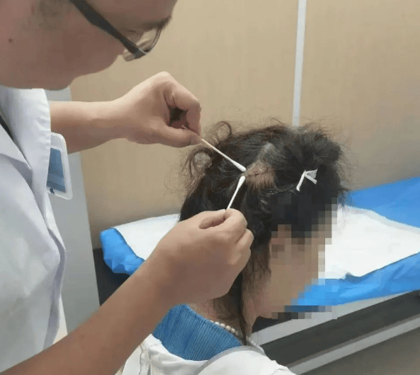 后脑勺缝了9针!女生这些场景戴它<strong></p>
<p>中国医药股票</strong>,等于顶了个“凶器”?