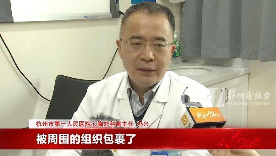 17岁小伙参军体检发现胸腔内有根5cm缝衣针<strong></p>
<p>梅雁吉祥股票</strong>,父母回忆或是1岁时扎入,取出时已锈迹斑斑